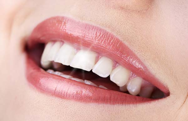 How A Cosmetic Dentist Uses Dental Bridges