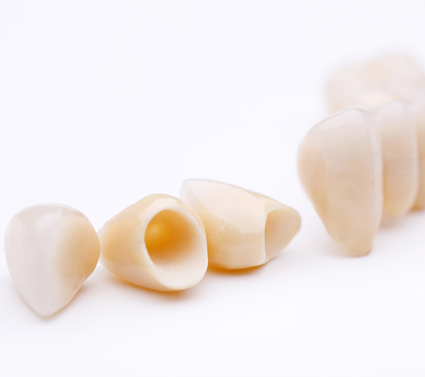 Philadelphia Dental Crowns and Dental Bridges