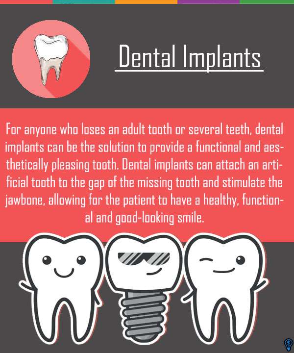 Dental Implants Are The Solution For Missing Teeth