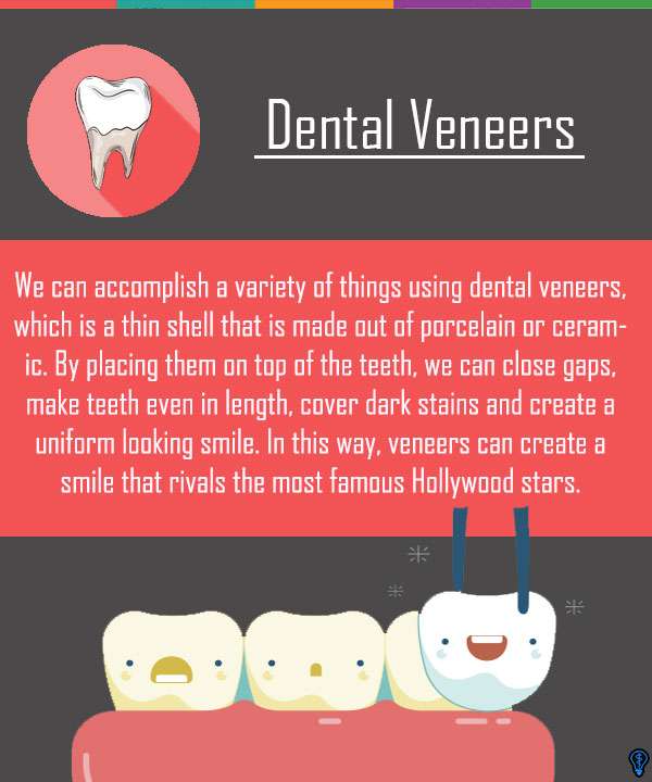 Dental Veneers and Dental Laminates Philadelphia, PA
