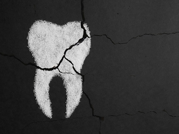 Tooth Decay Philadelphia, PA