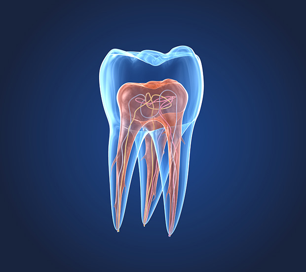 Philadelphia What is an Endodontist